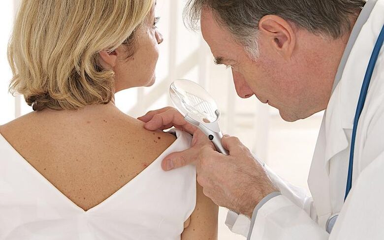 Women with papilloma at a doctor's appointment before taking Removio gel